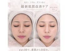 アンドユー(&you)の雰囲気（すっぴんに自信、持てていますか？隠す肌から、見せたい肌へ）