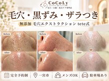ココリー(CoCoLy)