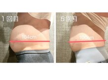 オーキッド(ORCHID)/痩身☆before/after