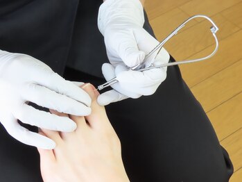 ドクターネイル爪革命 麻布十番店/【巻き爪ケア】フットケア