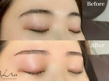 クレー(Klee)/アイブロウリフト