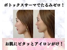 メディカルエース(MedicalAce)の雰囲気（定期ケアでキレイをキープ♪5年後のたるみ予防へ！）