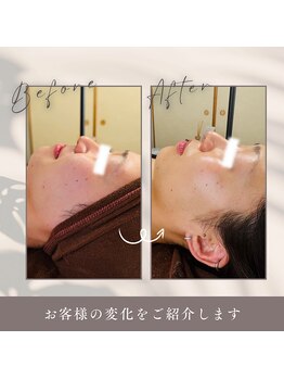 ルーク(Luke)/ビフォーアフター