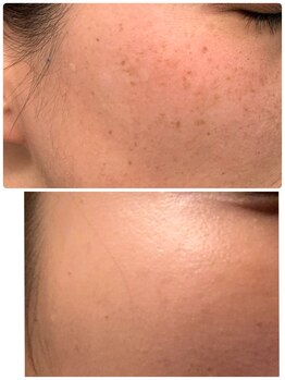 サロン エム(Salon M)/肌改善しみケア ドクターリセラ