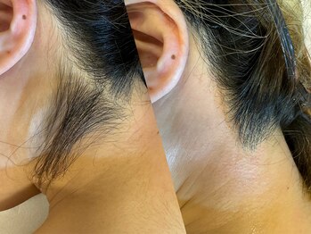 アンティーク(antique)/あっという間にツルすべに♪