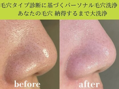 マナ(mana)の写真