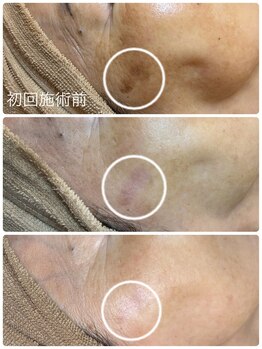 フィオーレ(fiore)/コンシーラいらなくなりました！