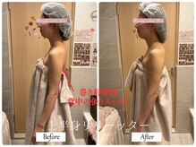 リノ(Lino)/ブライダルエステ