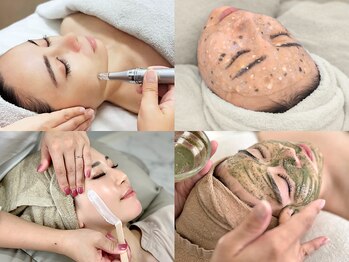 ヴィーナスプロ 岡山駅前(Venus Pro)の写真/顔脱毛(WAX)×肌質改善【顔脱毛(眉,ヘアライン込)+ハーブピーリング¥13000】産毛&角質オフでつるんと艶肌♪