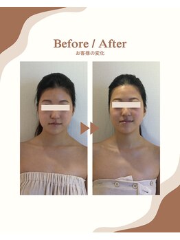 ビーキュート 学芸大学店(BE-CUTE)/Before/After 施術