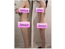 アムール(Amour)/最新型ハイパーナイフ＋姿勢矯正