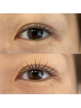 アイラッシュ ティル(eyelash till)/まつ毛パーマ　