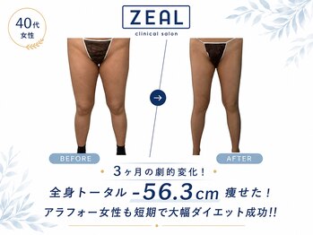 ジール 心斎橋(ZEAL)の写真/3ヶ月で理想の姿に変化し、本当の自分自身と出逢いませんか?