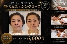 イーズ ミュゼ  ららぽーと横浜店