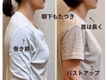 ル フラーズ(Les Fleurs)の雰囲気（辛い肩こりがなくなり、小顔が長持ちできる状態になりました）