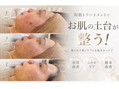 アンドエミニー エン ラボーテ(& EMINY 艶 la beaute)の写真