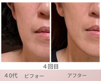 リアン(Lien)