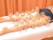 足浴堂/脚のカッピング