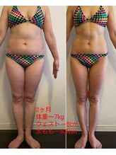 レナトゥス 銀座(Renatus)/中半身サイズダウン【痩身】