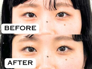 ビハリスト 恵比寿/目元がスッキリ!