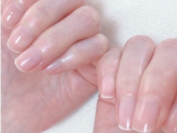 ブルーム(bloom)の写真/「ジェルネイルができなくても綺麗な爪へ」ジェルで爪が傷んでしまった方も◎爪の悩みはプロのケアで解消！
