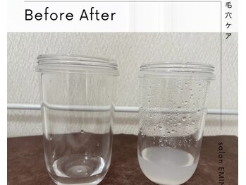 エミナル(EMINAL)/ハイドラフェイシャル