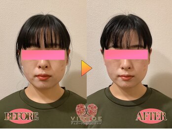 ヴィオーデ 錦糸町店/小顔、リンパ、ヘッドスパ、整体