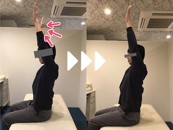 ミライズ整体院 三宮駅前院/事例【30代男性・背中の張り】