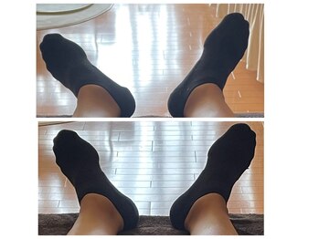 ソルビーフェイス(SOL*BeFace)/足の開きの左右差