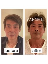 スパ 香炉/GUINOT美容機器VARフェイシャル