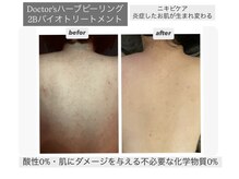 シャムリー 並木坂(Syamry)の雰囲気（見せれる背中に◎2Bバイオで背中のニキビ・色素沈着もケア）