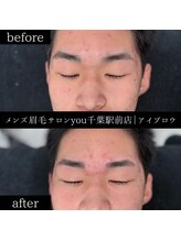 ユー 千葉駅前店(you)/ビフォ－アフター写真