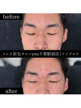 ユー 千葉駅前店(you)/ビフォ－アフター写真