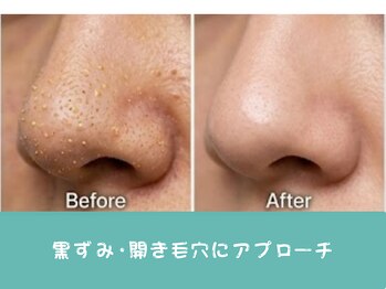 ココミエレ(COCO MIELE)の写真/【黒ずみ毛穴もつるん♪】蒸気×専用美容液で角栓を浮かしだす!プロ厳選の本格毛穴洗浄◎メンズ歓迎