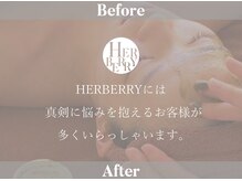 ハーバリー ハーブピーリング 金山店(HERBERRYハーブピーリング)/諦めないで！HERBERRYでは、