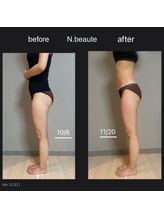 エヌボーテ(N. beaute)/下半身コース二回目