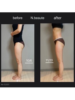 エヌボーテ(N. beaute)/下半身コース二回目