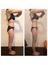 レナトゥス 銀座(Renatus)/二の腕＆前ももスッキリ♪