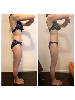 レナトゥス 銀座(Renatus)/二の腕＆前ももスッキリ♪