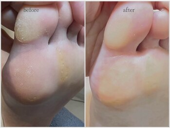 ロッタ(Lotta)/foot care.