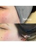 マリムーブフェイシャルWax＋ホームケア付き ¥9,900