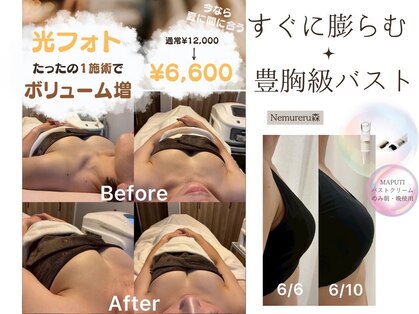 ネムレル森(Nemureru森)の写真