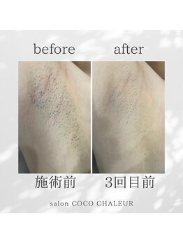 ココ シャルール(salon COCO CHALEUR)/Before　After