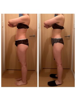 サロン ド マーシャ(salon de Marsha)/お尻の位置まで変わる！