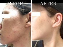 ヨサパーク ニコナ 三軒茶屋南口(YOSA PARK nicona)/代謝の力で内側からリセット！