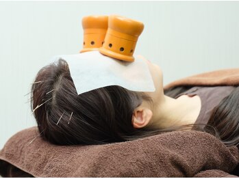 西小山弁天通り 鍼灸治療院/眼と頭の疲労緩和ケア♪