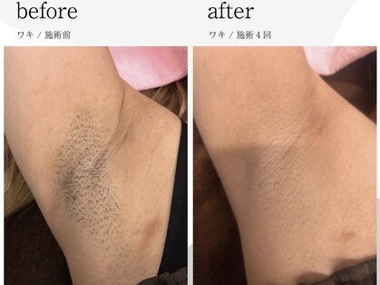 コンフォート ヤマガタ イン ショウナイ(comfort yamagata in shonai)の写真