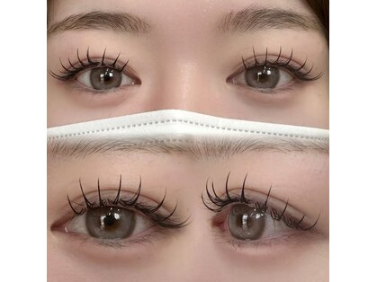 ベニー(Bennie)の写真