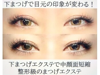 ビッグバンブー (Big bamboo)/メガフラット&エダムラッシュ