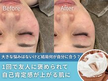 イロドリ(irodori)の雰囲気（１回の施術で「何かした？」と気付かれ、思わず笑ってしまう肌に）